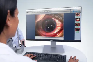 Software Keeler Konnect - aggiornamento Dicom