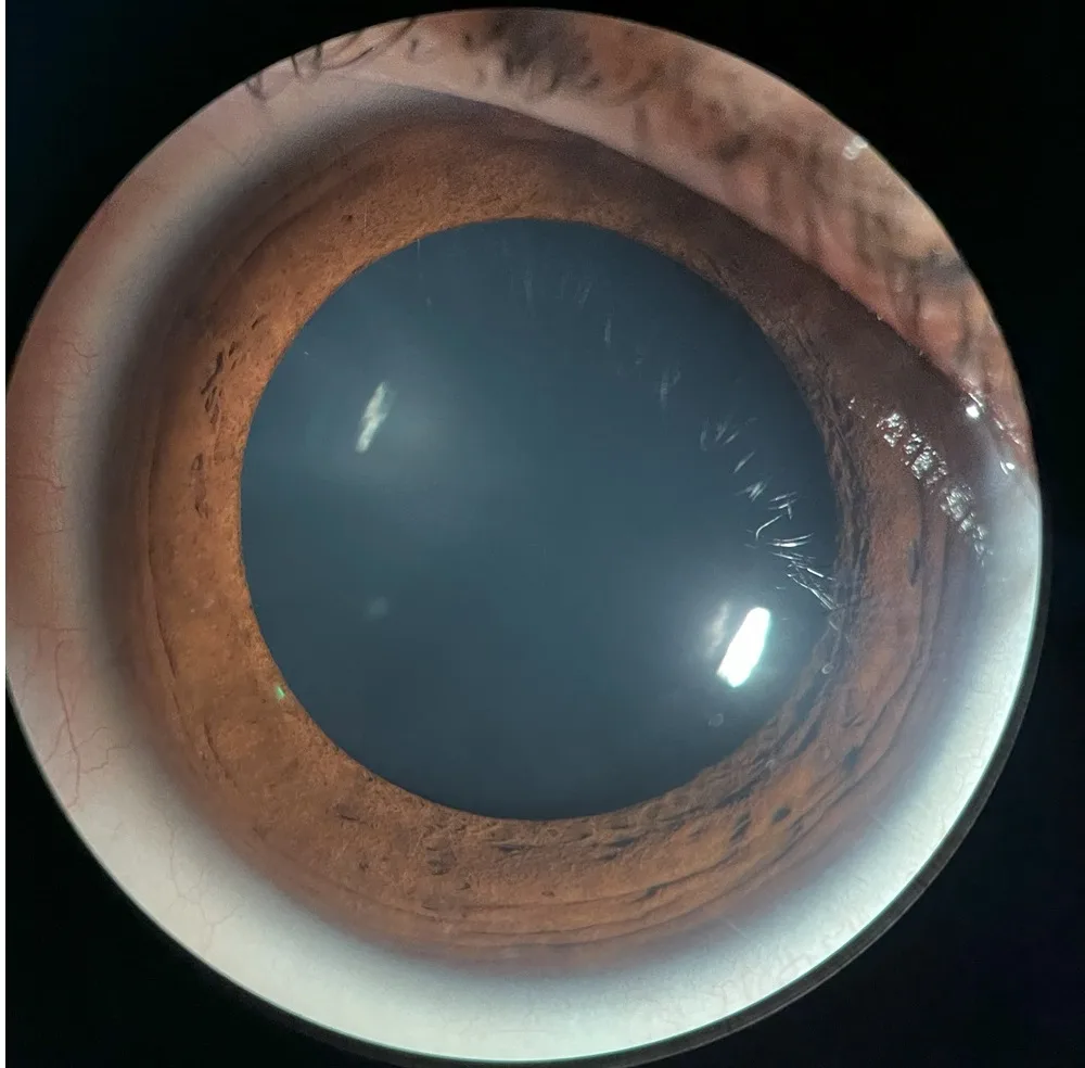 Simple guide to the most common optometry equipment names and uses