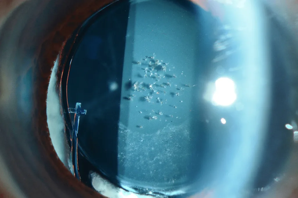 EyeNews 1st - Abigail James