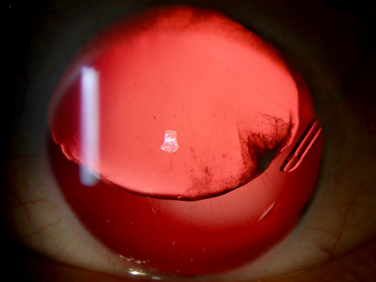 EyeNews_3rd - Vanessa Shepherd Brebner