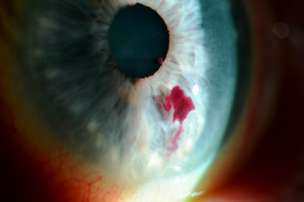 Celebrating 2025’s incredible winners as we launch this year’s Eye News ANTS competition!