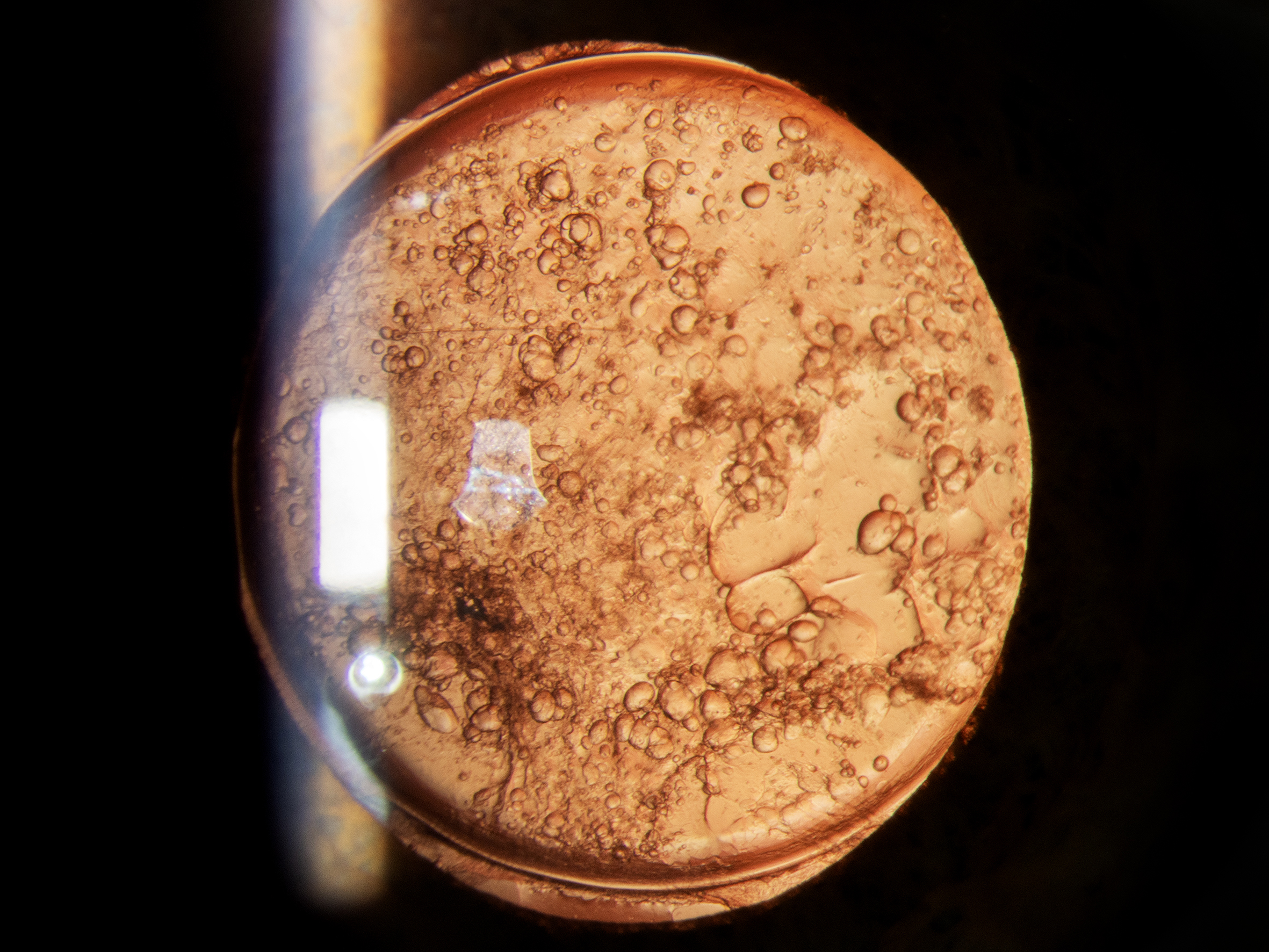 Announcing EyeNews ANTS competition 2026 winners!